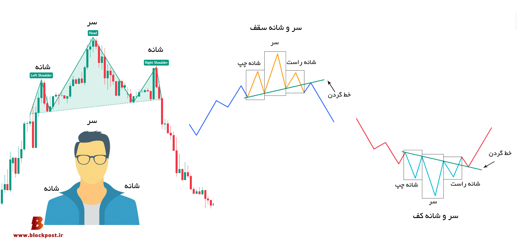 الگو سر و شانه