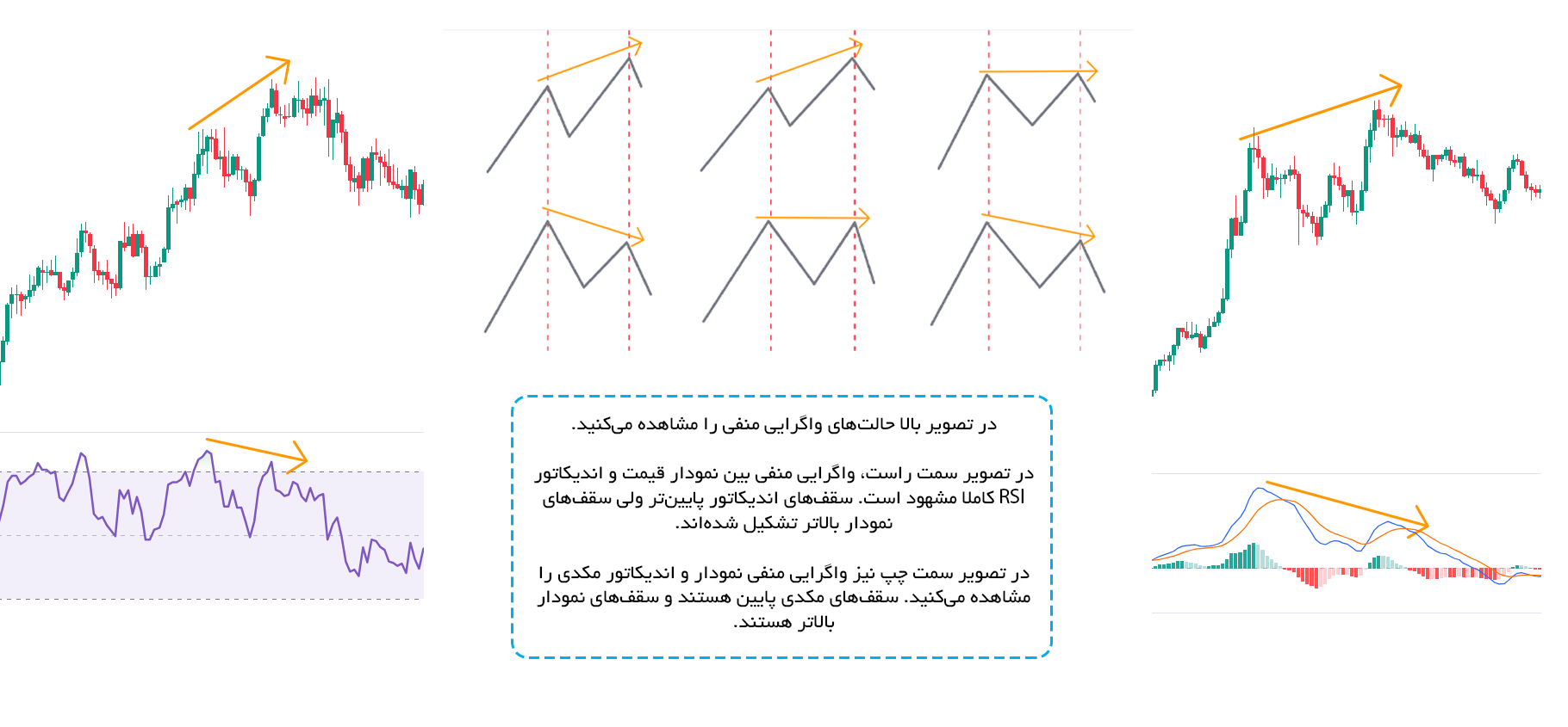 واگرایی معمولی منفی (RD-)